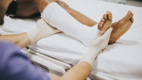 Doctor helping a patient with a fractured leg